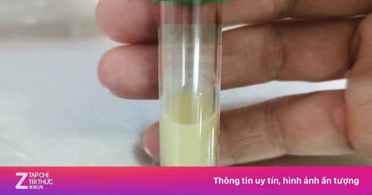 Vì sao gầy, sống 'healthy' vẫn mỡ máu cao, gan nhiễm mỡ?