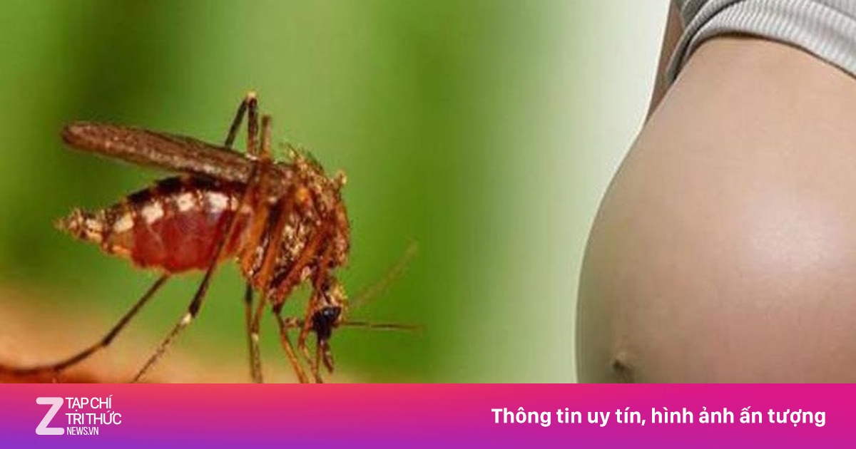 Đối tượng nào mắc sốt xuất huyết dễ bị trở nặng?