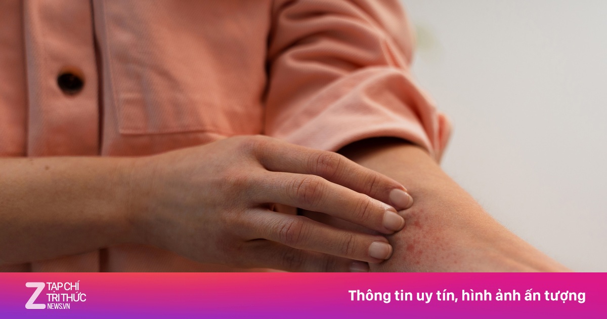 Dấu hiệu bạn đang sống chung với ký sinh trùng mà không biết