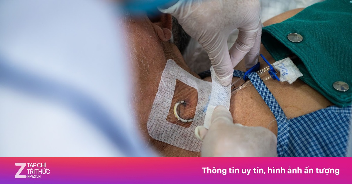 Thủ phạm 'tàn phá' mạch máu, đẩy người trẻ vào đột quỵ: Cảnh báo từ chuyên gia