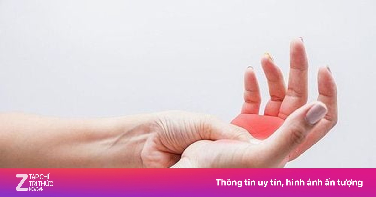 Tê tay chân liên tục, cảnh giác bệnh nguy hiểm hiếm gặp