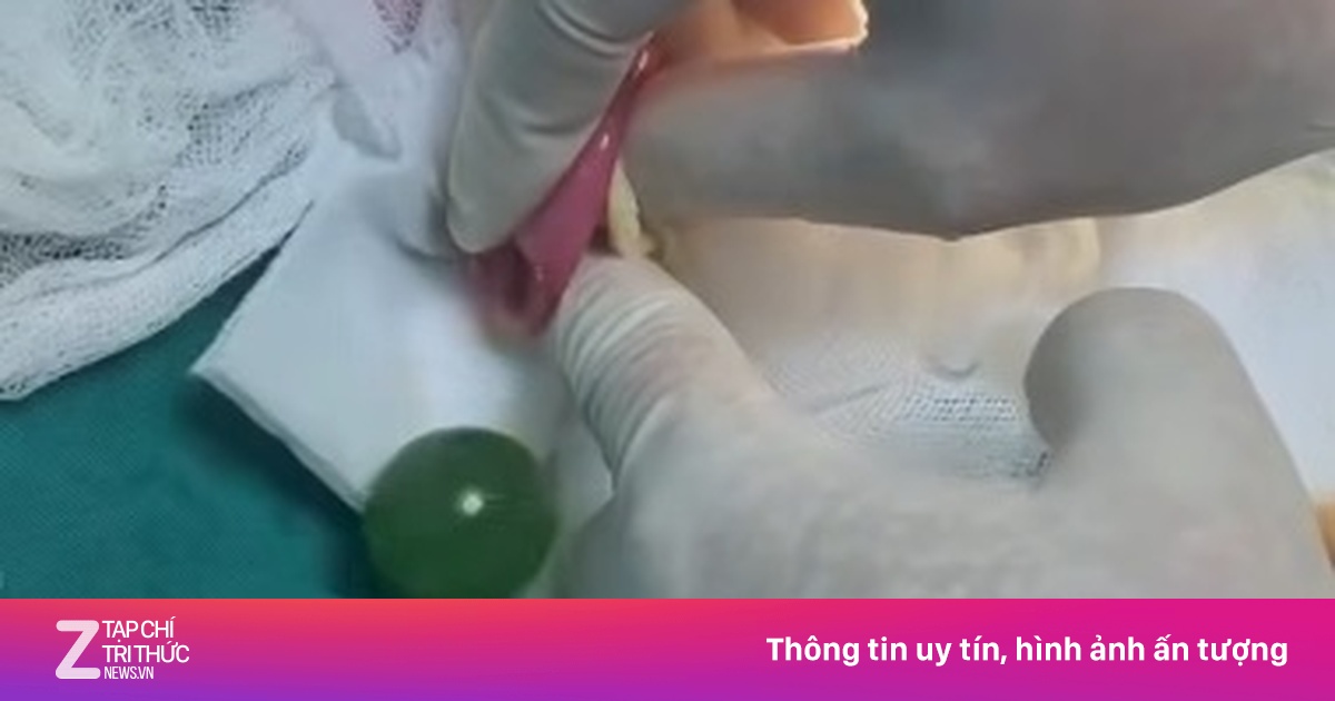 Bố mẹ bất ngờ khi biết lý do khiến con trai ăn gì nôn nấy suốt 2 ngày