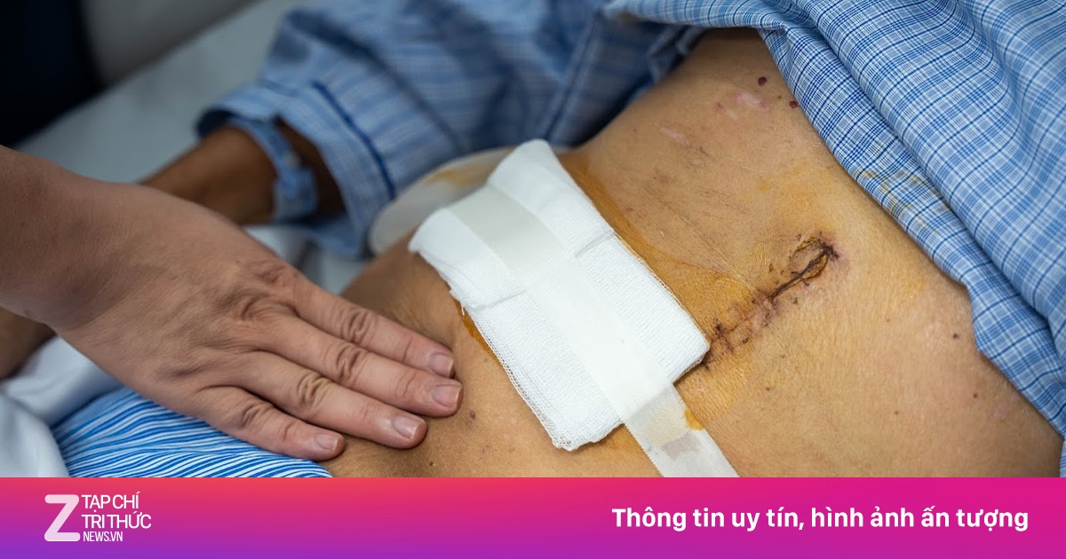 Từ hai triệu chứng lặp lại, người đàn ông phát hiện ung thư gan