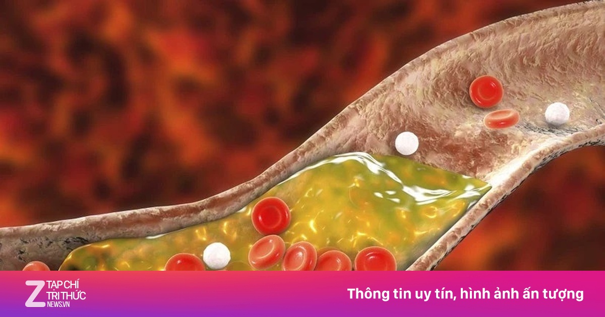 Kiểu ăn uống khiến mỡ máu tăng nhanh