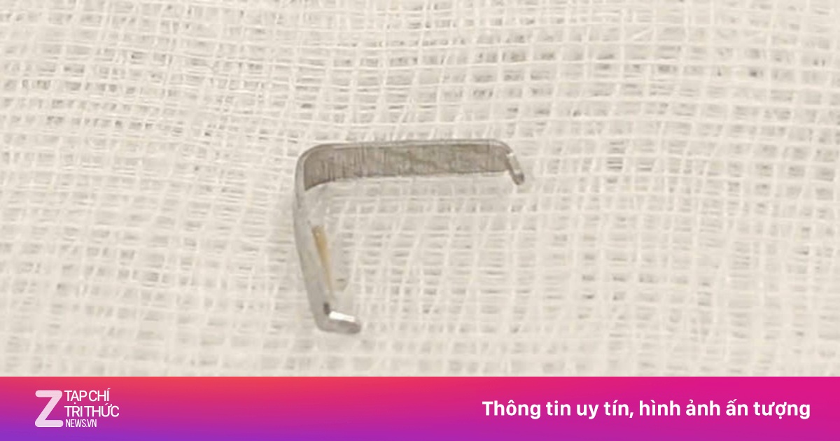 Bé trai quấy khóc, bác sĩ tá hỏa phát hiện vật sắc nhọn găm trong họng