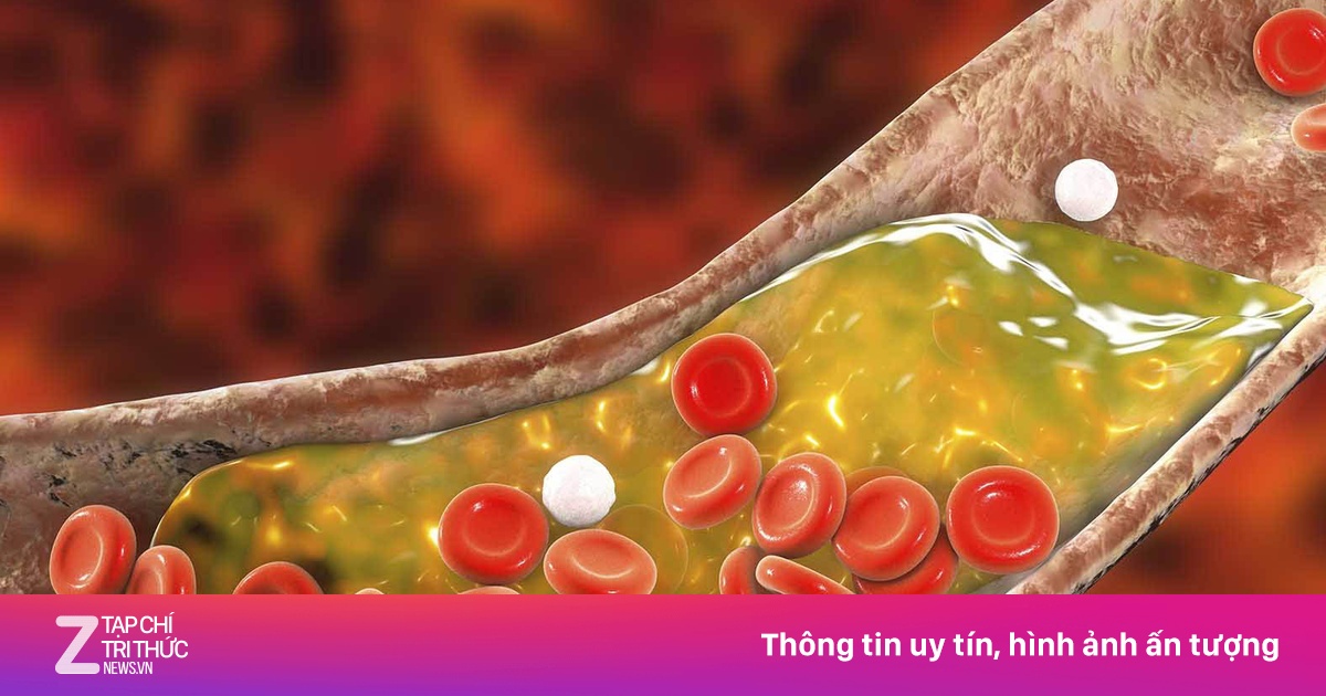 Cách hạ mỡ máu tự nhiên, càng duy trì càng hiệu quả
