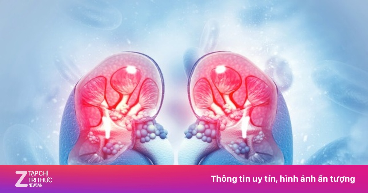 Hội Chứng Thận Hư: Dấu Hiệu Nhận Biết Sớm Và Phương Pháp Điều Trị Hiệu Quả