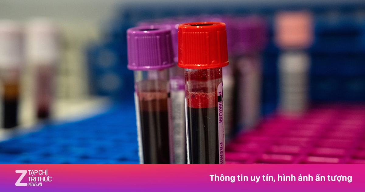 Người Nhật 'Kỳ Thị' Nhóm Máu B: Định Kiến Văn Hóa Hay Khoa Học?