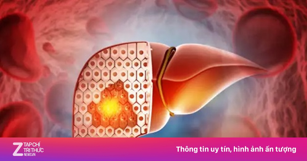 Khi 'thuốc bổ' hóa độc dược: Sai lầm tàn phá gan của nhiều người Việt