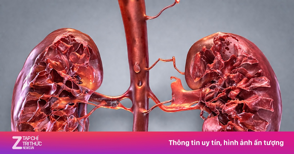Sai lầm ăn uống âm thầm tàn phá thận