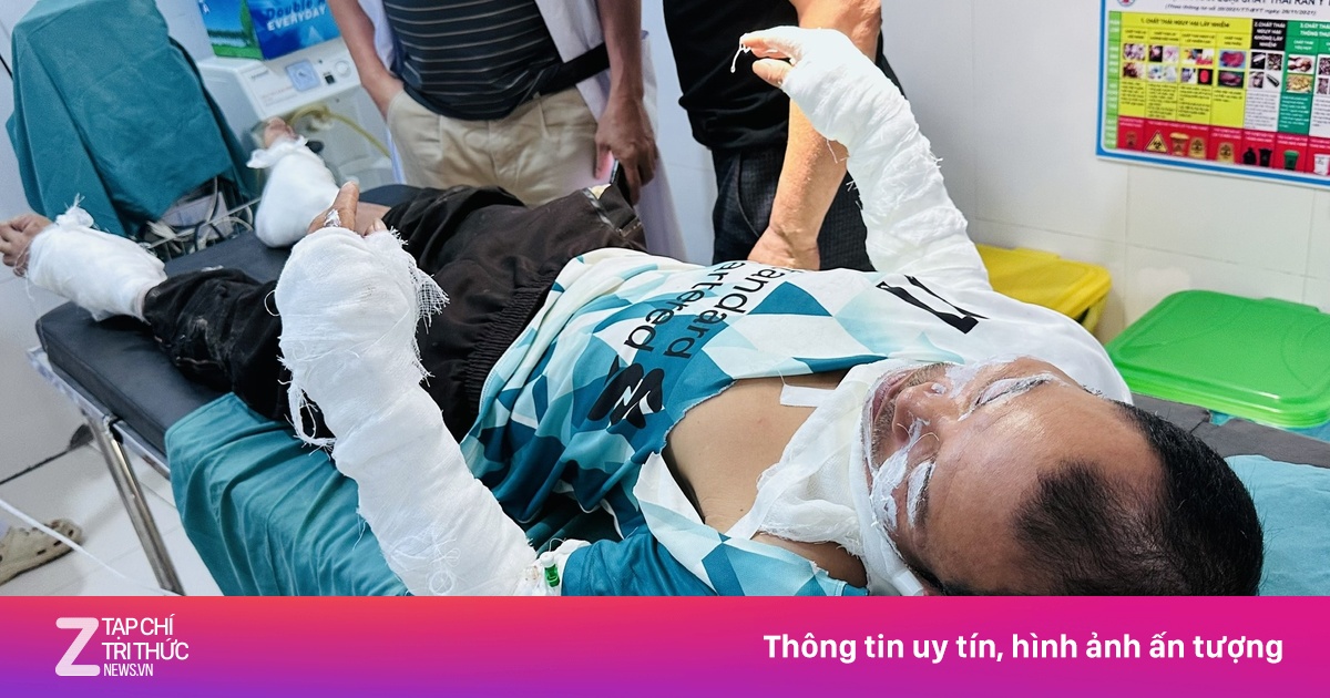 Tai nạn kinh hoàng khi thui thịt chó bằng bình gas: Hai người bỏng nặng