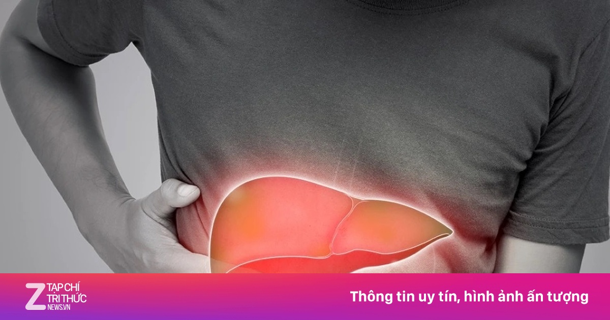 6 dấu hiệu cảnh báo gan nhiễm mỡ, nhiều người hay gặp nhưng lại ngó lơ