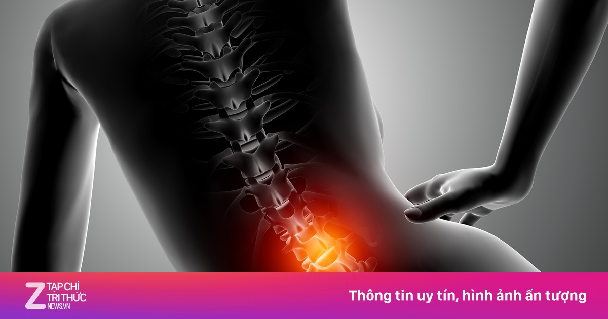 Vì sao dân văn phòng dễ thoát vị đĩa đệm dù không lao động nặng?