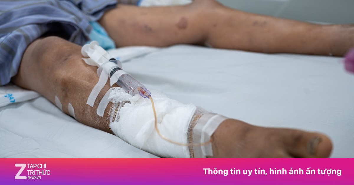 Vết trầy nhỏ khiến người đàn ông tiên lượng rất cao không qua khỏi