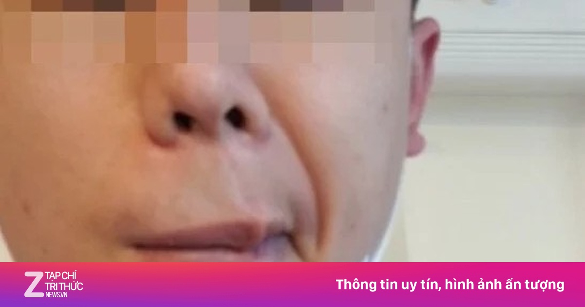 zingnews.vn
