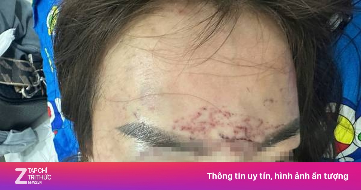 Khởi tố vụ người phụ nữ đi đường bị kéo lên ôtô, 'tra tấn' bằng axit