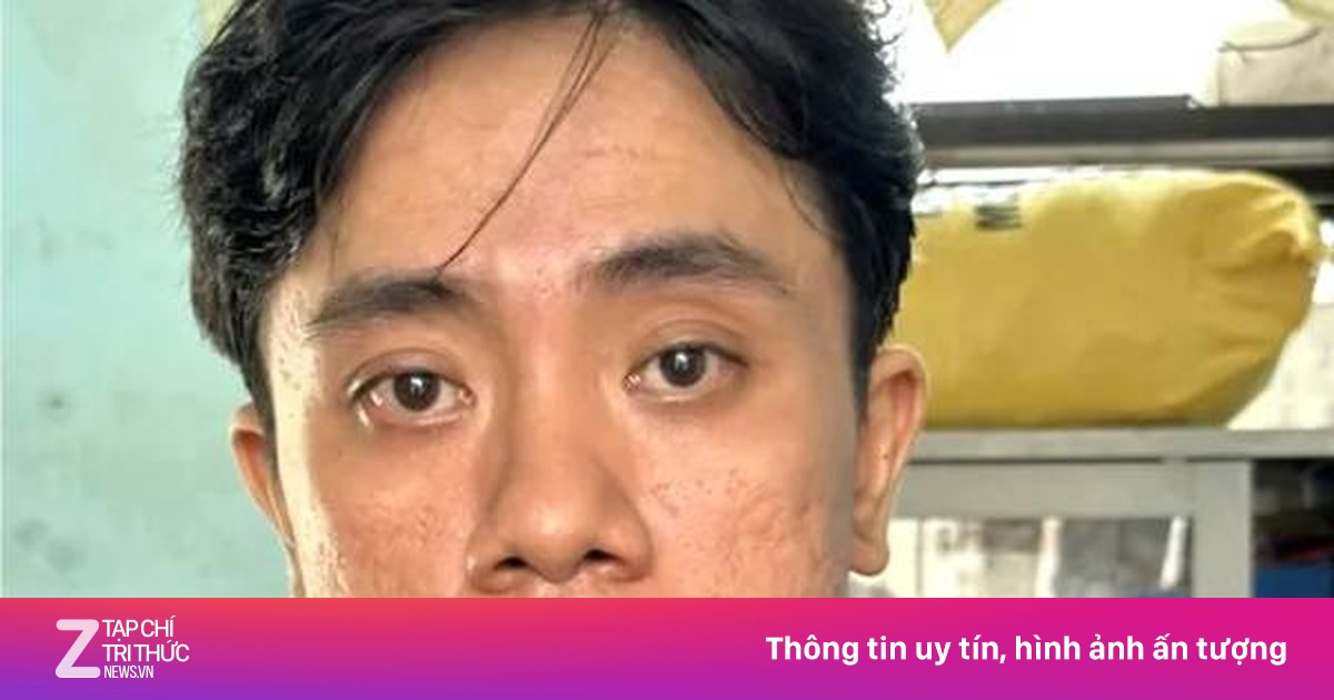 Ở cùng nhà với dì, cháu trai nhiều lần trộm vàng mang bán