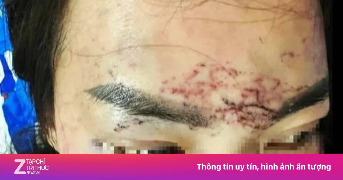 Khởi tố 2 người phụ nữ trong vụ 'tố' bị đánh đập, xăm mặt vì ghen