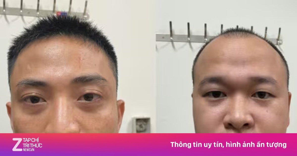 Thủ đoạn lừa đảo dưới hình thức 'mua trả góp' của nhóm tội phạm