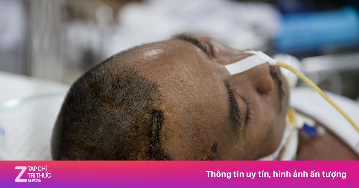 Phía sau những chiếc giường 'chưa biết ngày tỉnh' ở Bệnh viện Chợ Rẫy