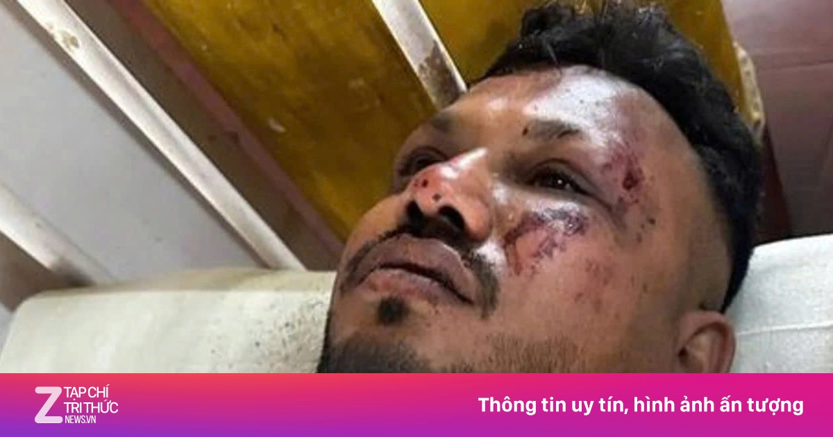 Phép màu 'sống sót duy nhất' như thảm kịch Air India có hy hữu?