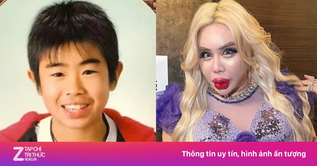 Dao kéo hơn 200 lần để thành 'người đẹp nhất thế giới'