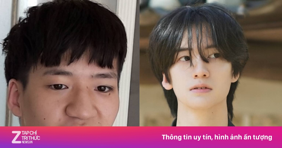 Chàng trai Hàn gây sốc với màn 'lột xác', khẳng định không dao kéo