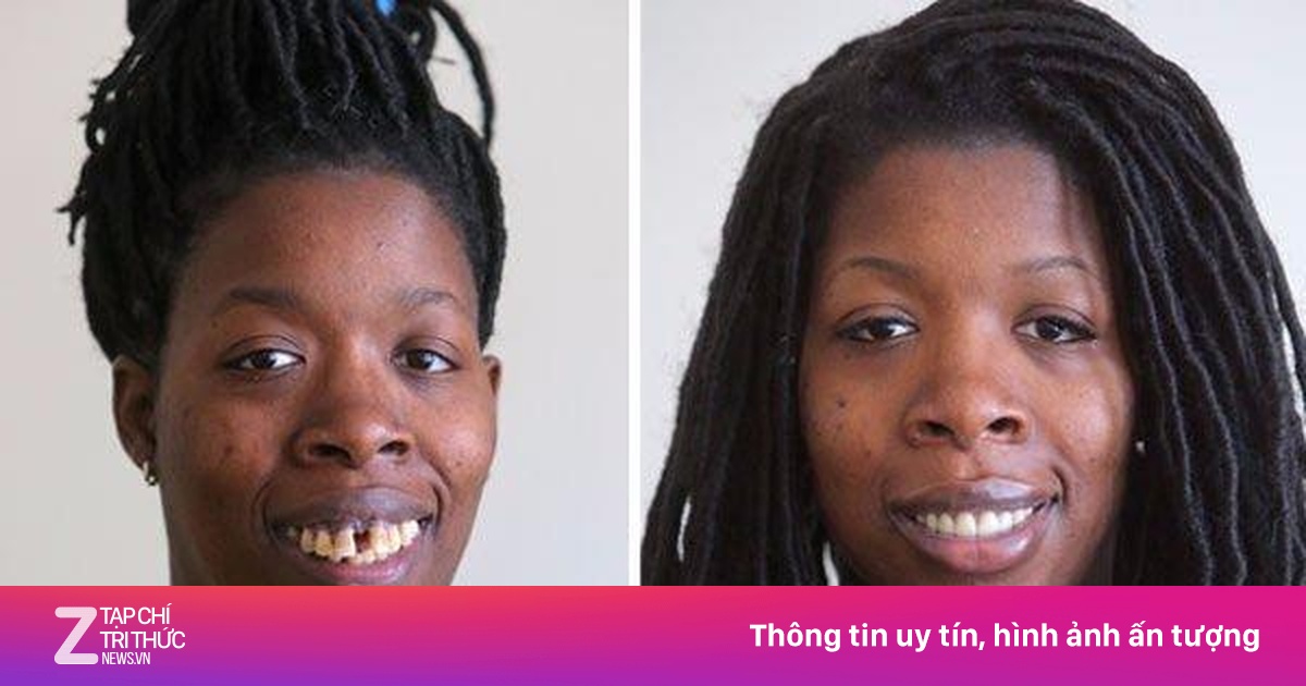 Cái kết bất ngờ cho người phụ nữ bị chế giễu vì hàm răng xấu xí | Znews.vn