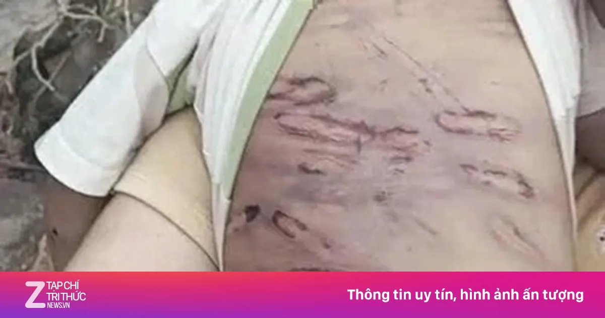 Nỗi đau trẻ thơ: Lời cảnh báo từ hai vụ bạo hành nghiêm trọng