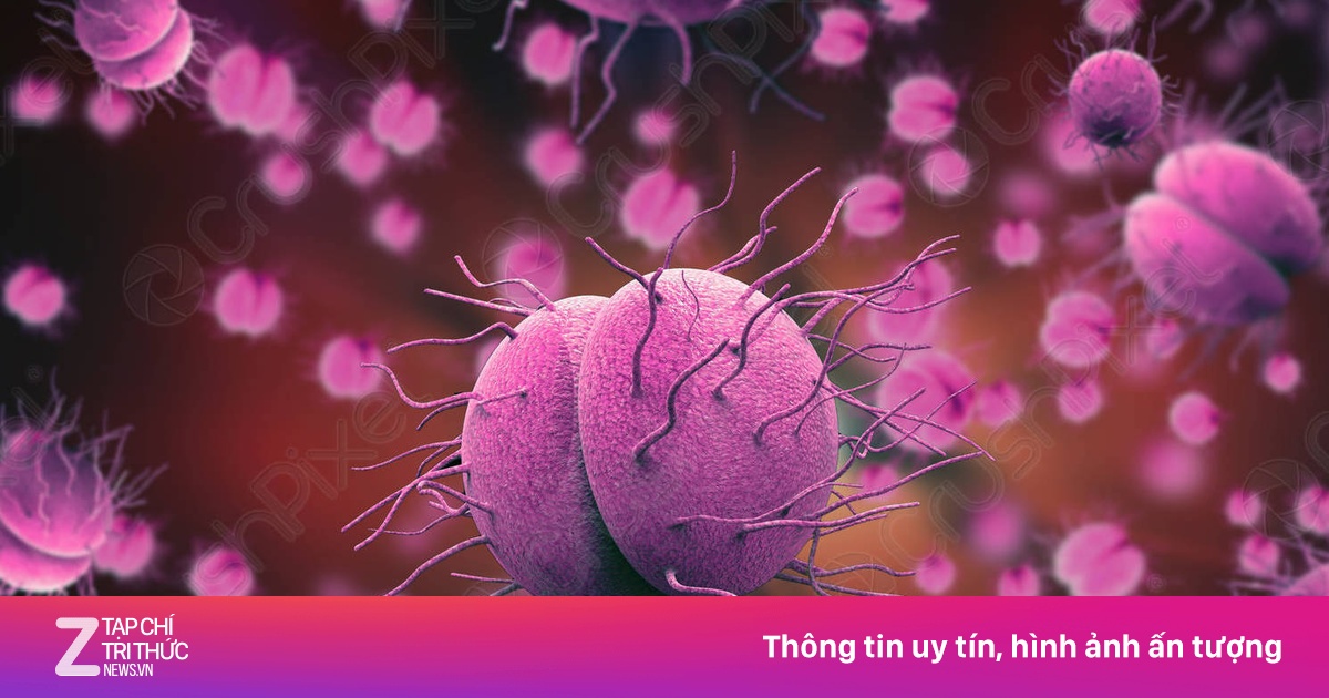 zingnews.vn