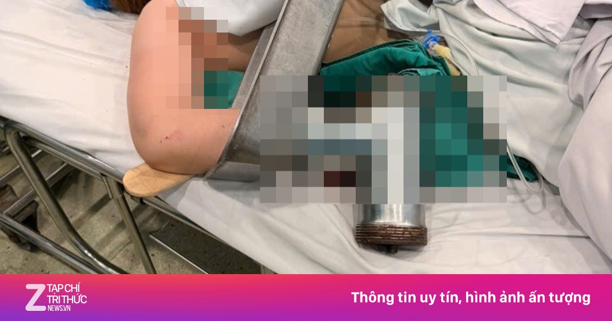Nhập viện thương tâm với bàn tay kẹt cứng trong máy xay