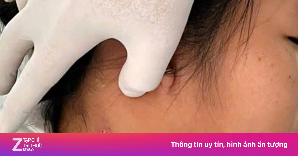 Thái Lan cảnh báo khẩn về bệnh Whitmore: 'Quả bom nổ chậm' với triệu chứng dễ nhầm lẫn