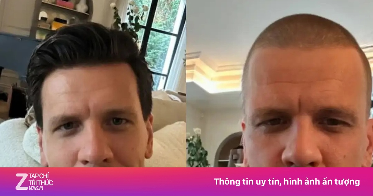 Szczesny mắc sai lầm phải cạo trọc