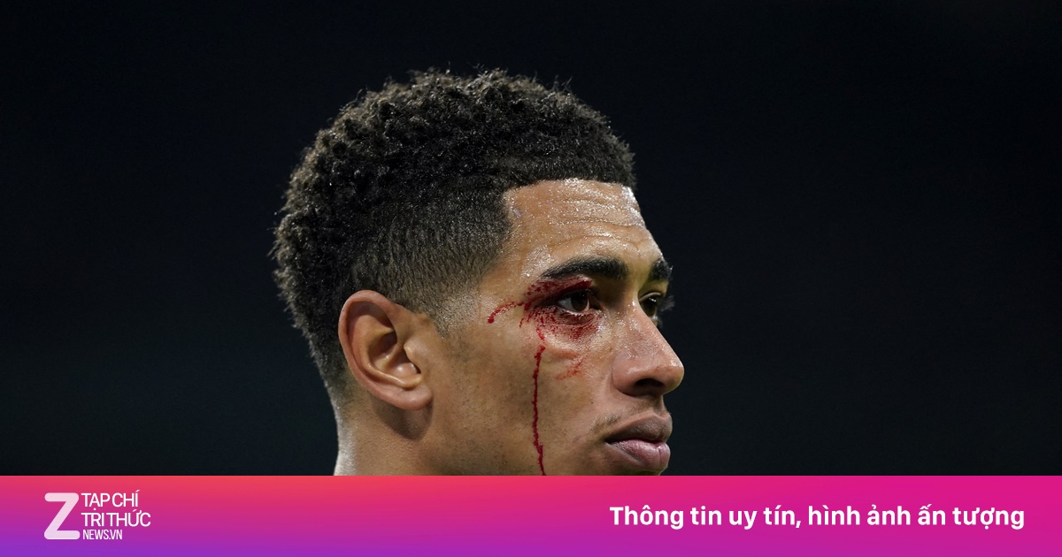 Mặt rướm máu của Bellingham