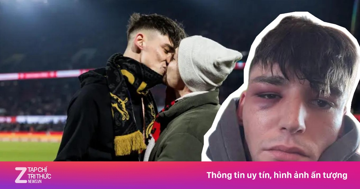 Trọng tài cầu hôn bạn trai bị đánh bầm mắt