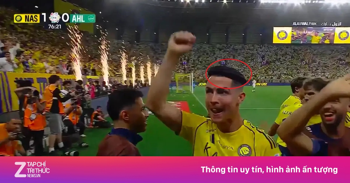 Chiếc vòng đen bí ẩn trên đầu Ronaldo