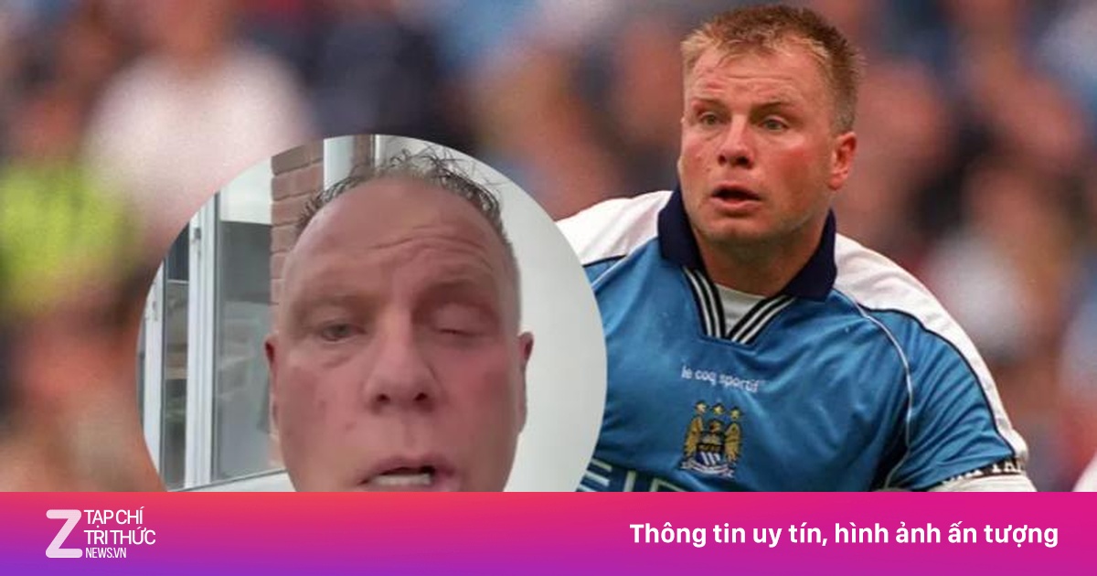 Mặt biến dạng của cựu đội trưởng Man City