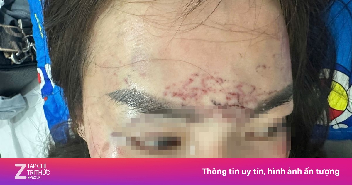 Người phụ nữ bị kéo lên ôtô, ‘tra tấn’ bằng axit và máy xăm ở Cà Mau
