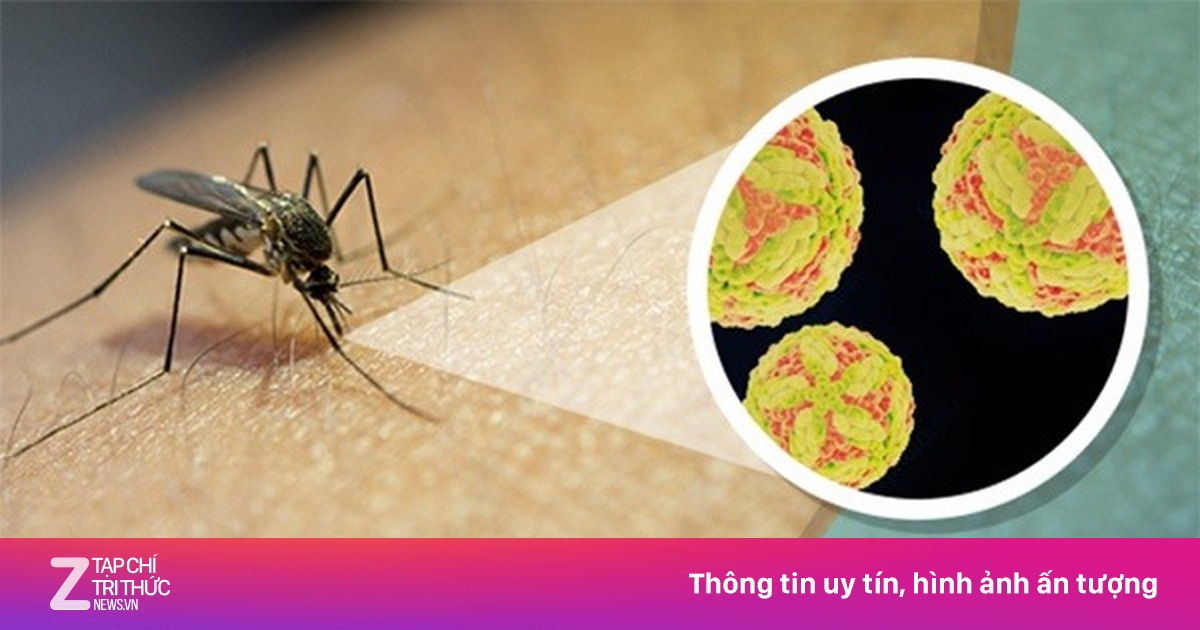 Dấu hiệu điển hình bệnh viêm não Nhật Bản