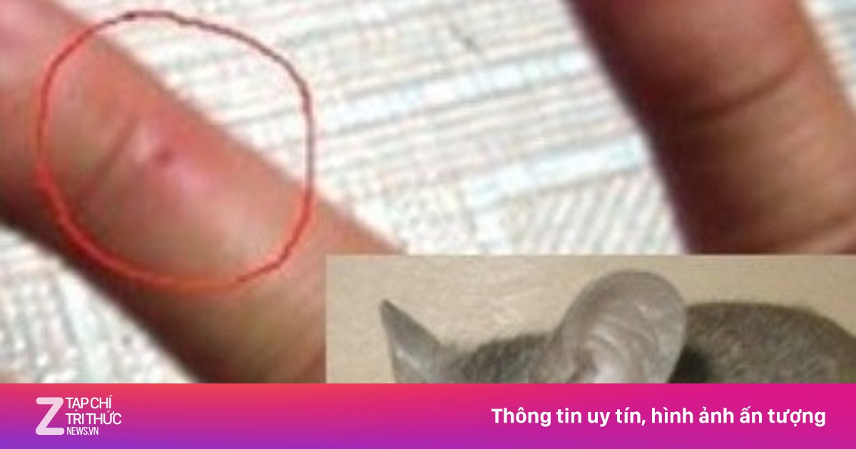 Những bệnh có thể lây nhiễm từ chuột và cách phòng