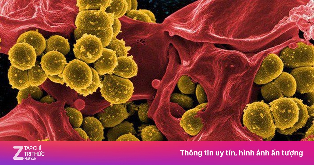 Nhiễm tụ cầu vàng có thể gây nguy kịch, phòng ngừa cách nào?