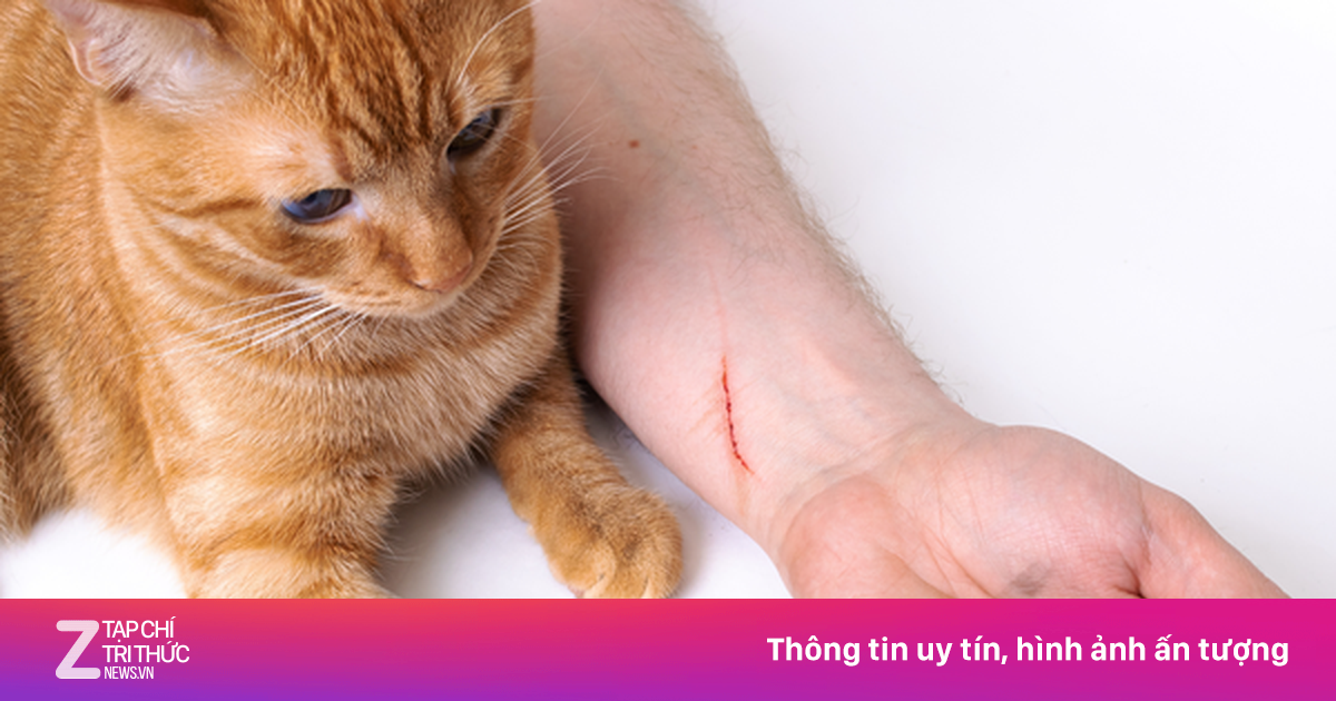 Bé trai không qua khỏi vì mèo cào
