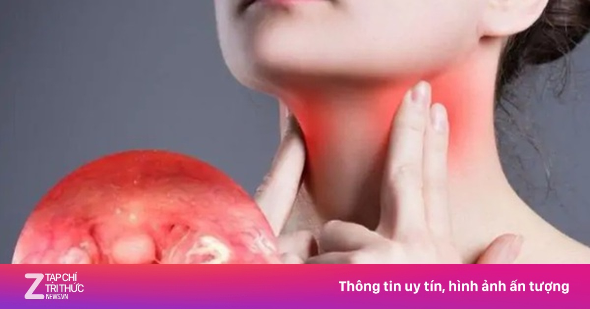 Viêm họng cấp có thể gây ra biến chứng gì?