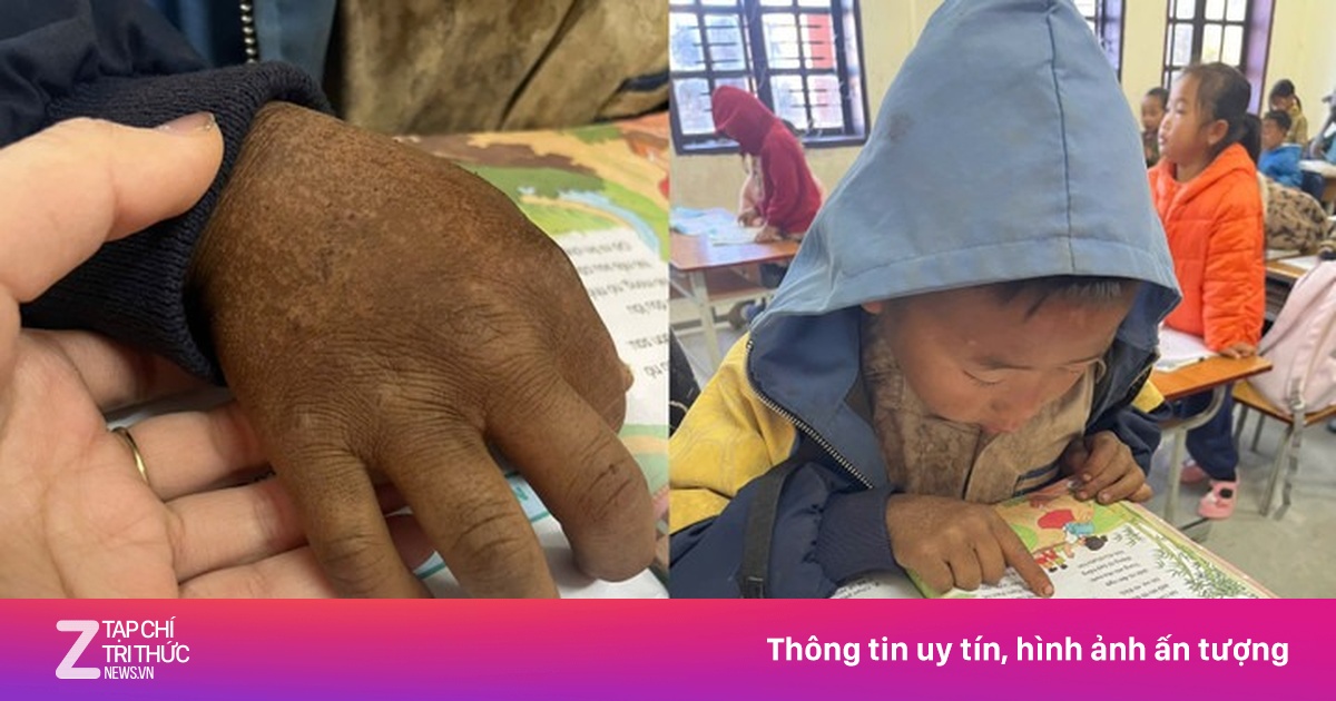 Bàn tay nứt nẻ của cậu bé 8 tuổi vùng cao khiến triệu người nghẹn lại