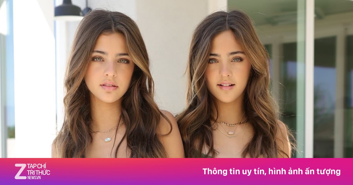 Tuổi 15 của 'cặp song sinh đẹp nhất thế giới'