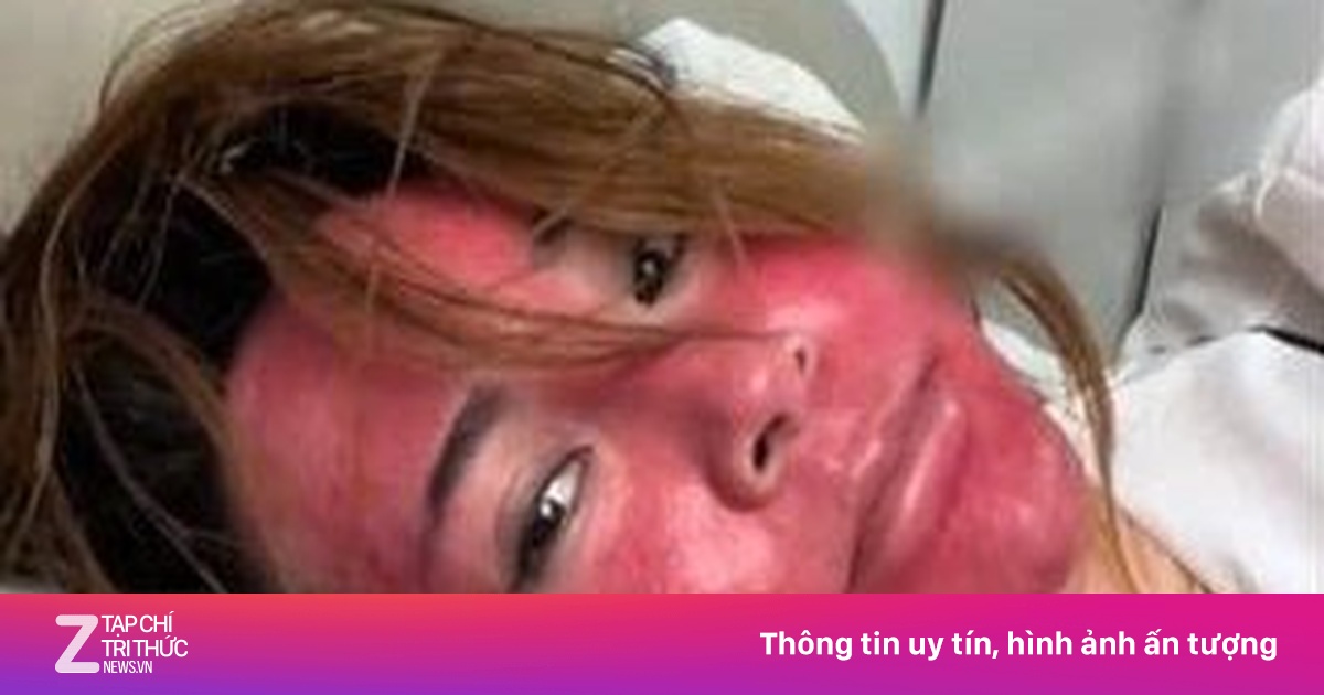 Sốc với khuôn mặt của người phụ nữ Trung Quốc 22 năm không tẩy trang