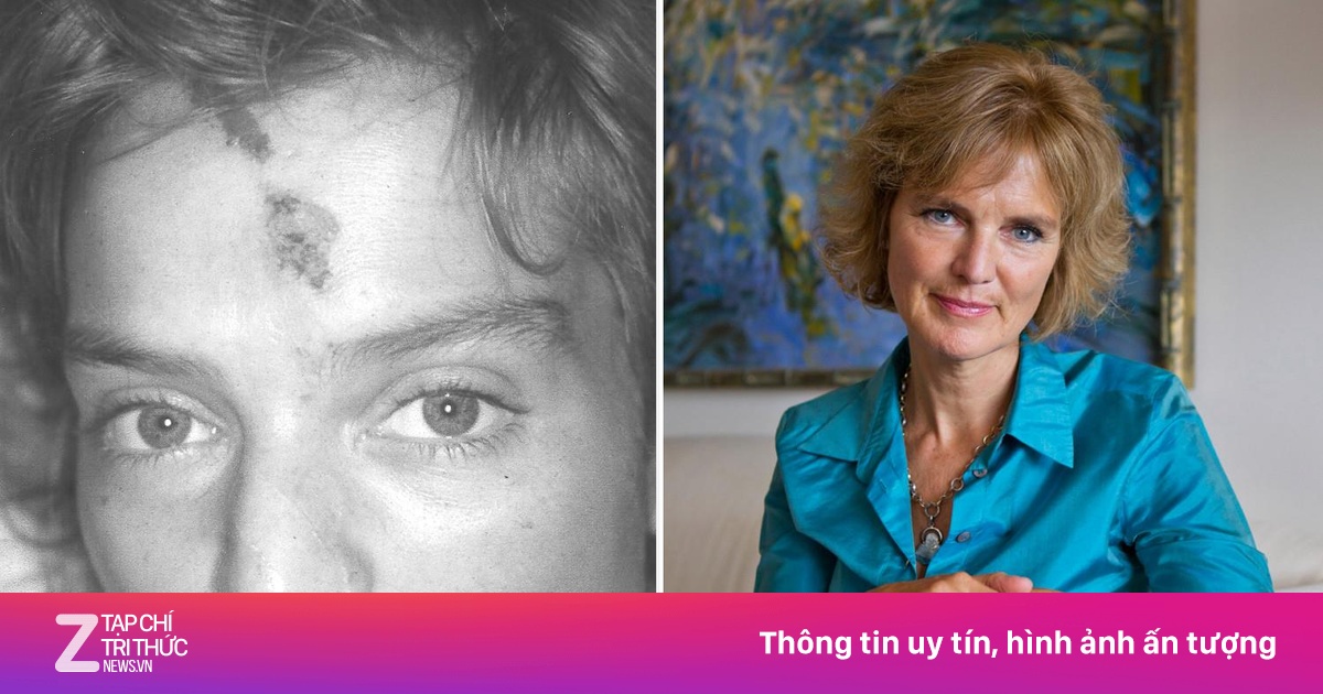 Cuộc chống chọi với đau đớn, đói khát của cô gái khi máy bay rơi vỡ ná