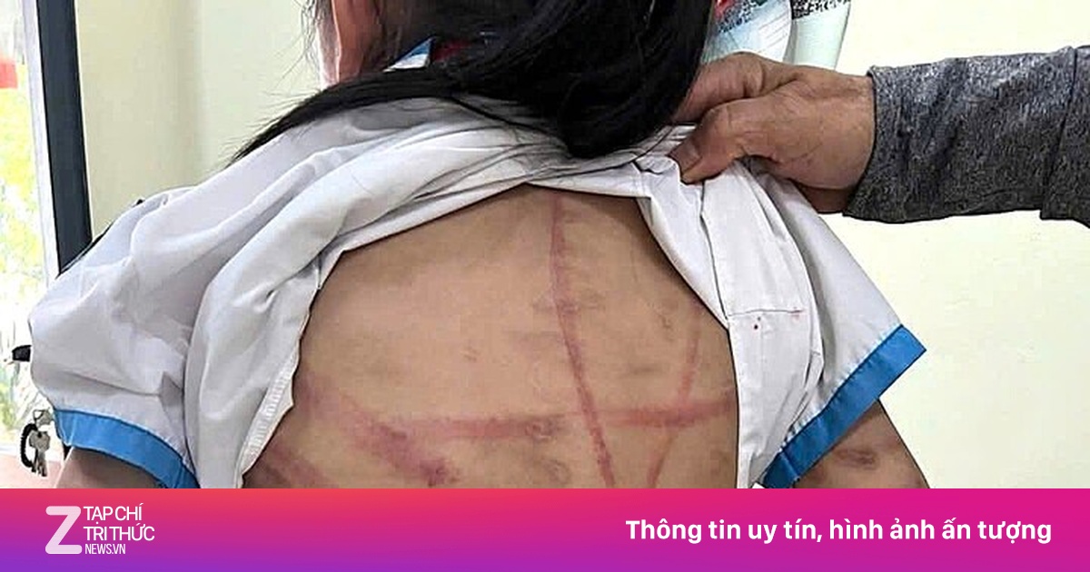 Bắt giữ cha dượng bạo hành dã man bé gái lớp 5 ở Hà Tĩnh