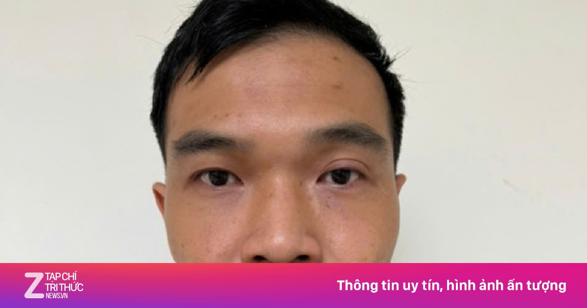 Màn 'biến hình' không hoàn hảo của đối tượng cướp giật 5 chỉ vàng