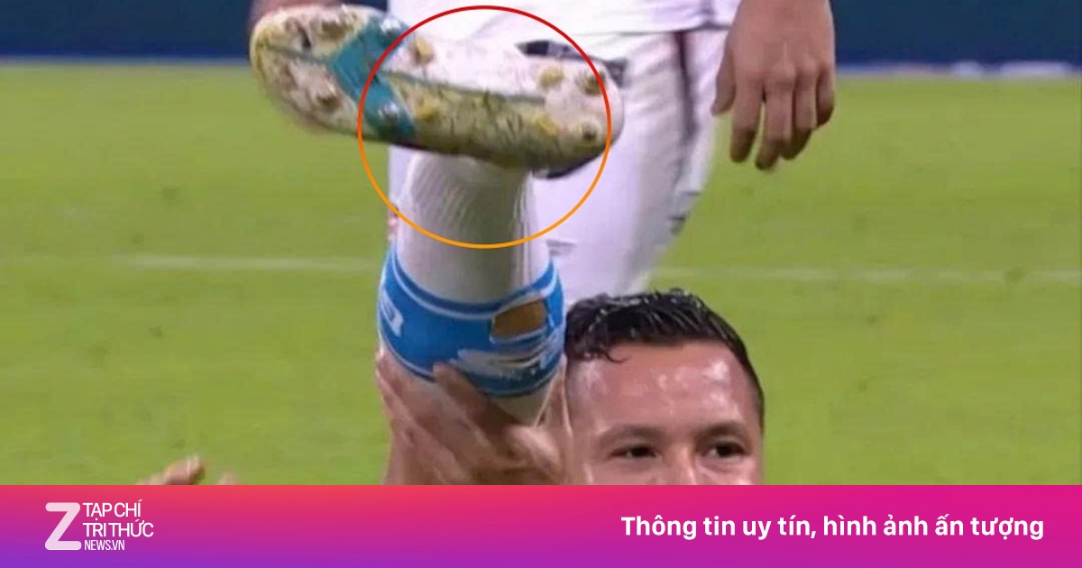 Cầu thủ Brazil bình thản dù cổ chân bị gãy